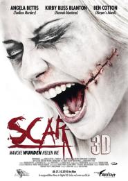 Scar 3D