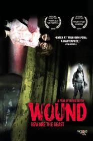 Wound: Beware the Beast