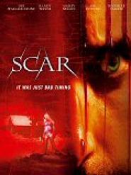 Scar